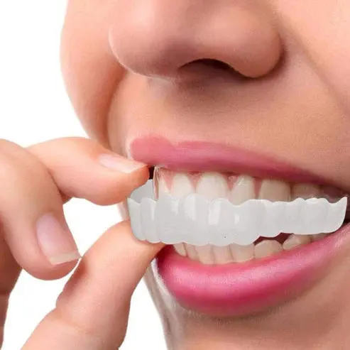 Clip-on Zahnveneers Set formbar | Sofort weißeres Lächeln in Sekunden | Wiederverwendbar & zahnschonend | 1 Set in Weiß
