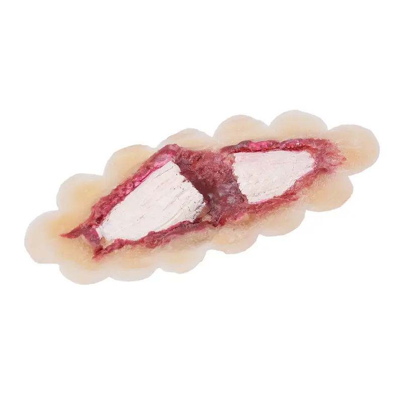 Latex Protheses Bone Fracture 810