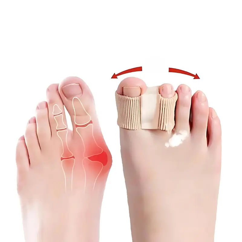 Premium Zehentrenner | Elastische Separatoren für Ballenzehen & Fehlstellungen | Nylon & SEBS